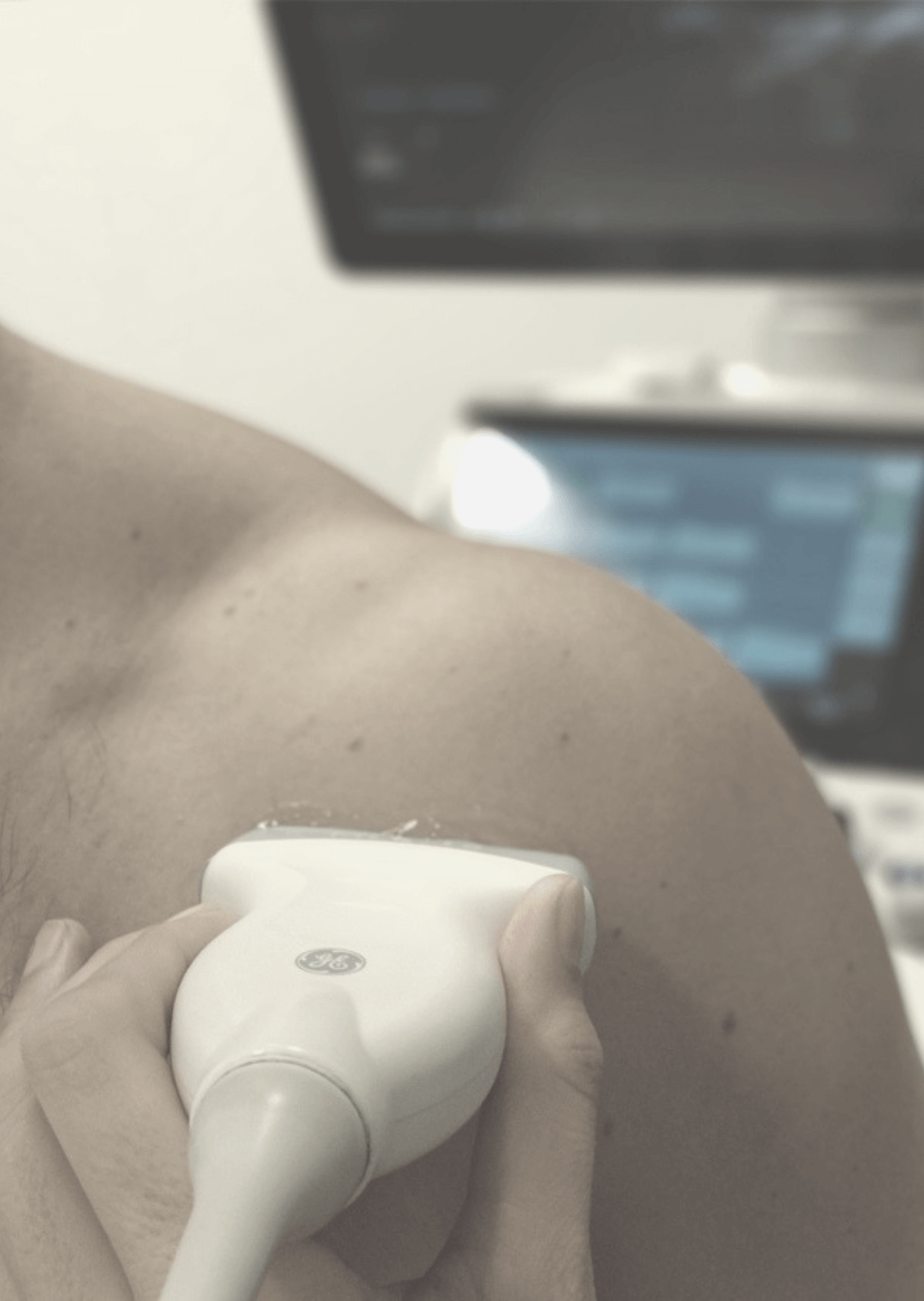 xlii-ecografia-musculoesqueletica